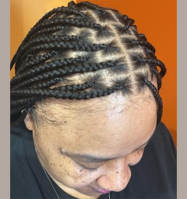 hair braids